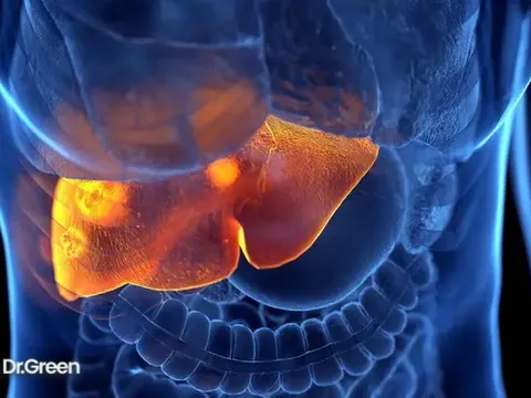 Nghiên cứu mới: Thứ ngọt ngào vạn người mê - "Sát thủ" tăng 78% nguy cơ ung thư gan