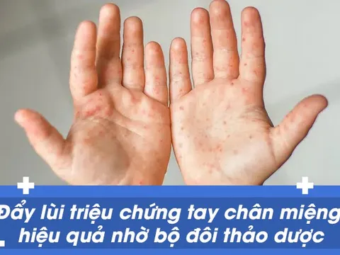 Đẩy lùi triệu chứng tay chân miệng hiệu quả nhờ bộ đôi thảo dược