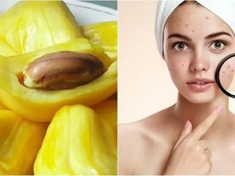 Những ai không nên ăn mít?