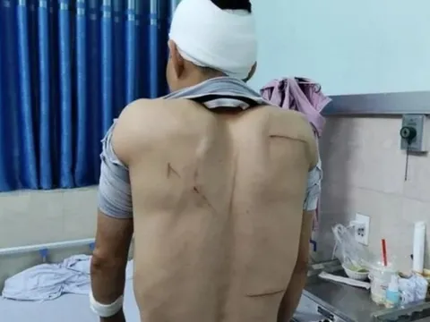 Hải Phòng: Truy bắt nhóm chém người trọng thương ở cổng bệnh viện