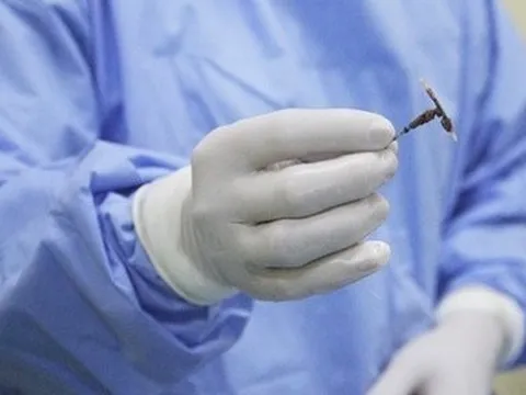 Bạc Liêu: Lấy vòng tránh thai hóa sỏi “rơi” vào bàng quang