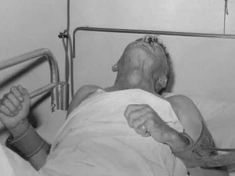 Bến Tre: Bệnh dại diễn biến phức tạp, ngành y tế chỉ đạo khẩn