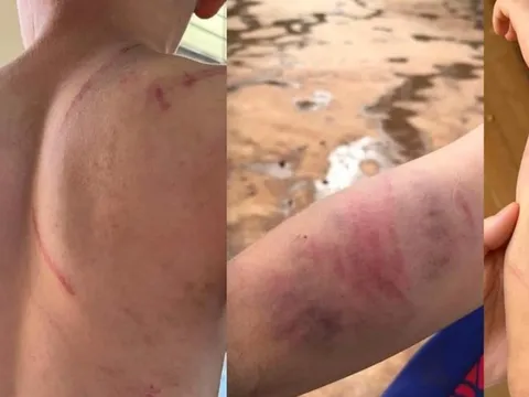 Xác minh thông tin cháu bé 9 tuổi nghi bị cha và bà nội đánh đập