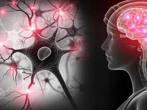 Một bệnh não hoàn toàn mới xuất hiện ở 40% người cao tuổi