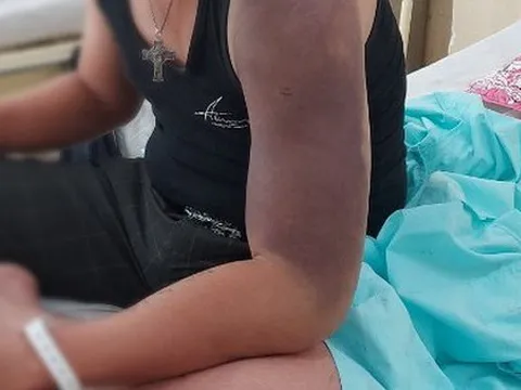 Một bệnh nhân sốt xuất huyết tử vong sau khi truyền dịch tại phòng khám