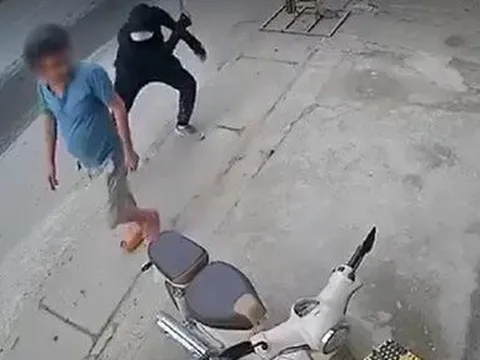 Đang đi trên đường, người đàn ông bị kẻ lạ mặt chém lìa chân