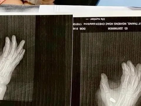 Thanh Hóa: Nổ súng tại quán karaoke, một cháu bé trúng đạn bị thương