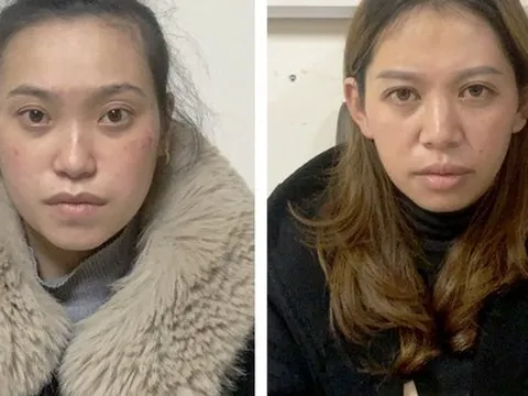 Bắt giam 2 bảo mẫu bạo hành cháu bé 2 tuổi dã man ở Đà Lạt