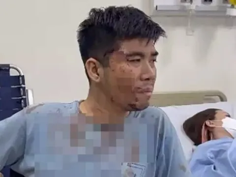 Tp.HCM: Bắt 8 người vụ hỗn chiến do mâu thuẫn của những đứa trẻ