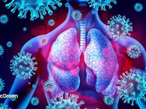 Cảnh báo tình trạng ‘siêu nhiễm trùng’ ở bệnh nhân COVID-19