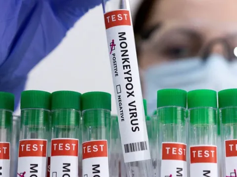 WHO tuyên bố đậu mùa khỉ là tình trạng khẩn cấp toàn cầu: Triệu chứng "rất khác" cần chú ý