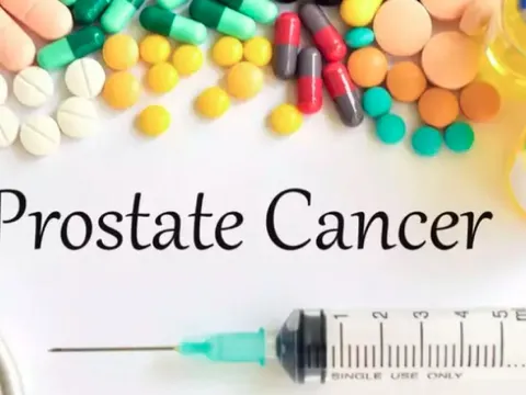 Dấu hiệu sớm của ung thư tiền liệt tuyến mà đàn ông không nên bỏ qua