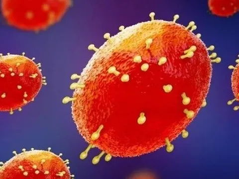 Virus đậu mùa khỉ có lây qua nụ hôn hay không?