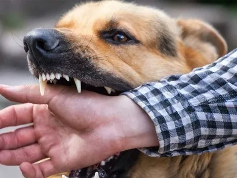 Người đàn ông tử vong sau 3 tháng bị chó con cắn tay