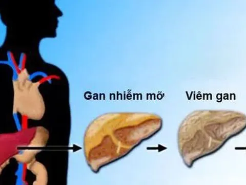 Mùa hè, gan thích nhất những thực phẩm này, nên bổ sung ngay để kéo dài tuổi thọ