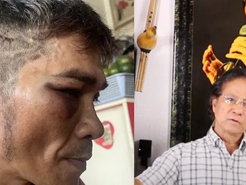 Con trai Chế Linh bị đánh hội đồng, người cha từ Mỹ nói gì?