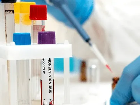 Thêm nước Đông Nam Á có đậu mùa khỉ, WHO nghi Ebola tái xuất