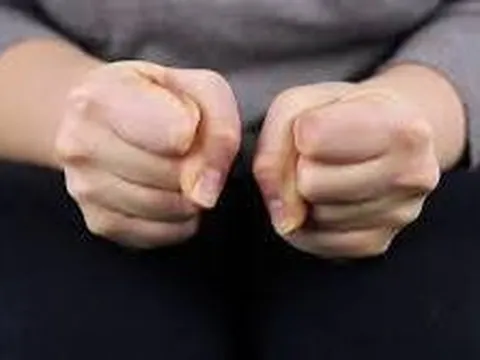 Giấu tay khi giao tiếp, tưởng là bất lịch sự, hóa ra mắc căn bệnh 1-3% dân số gặp phải