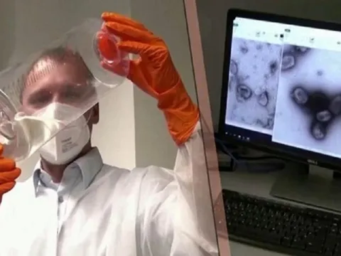 WHO nghiên cứu đột biến gen của bệnh đậu mùa khỉ