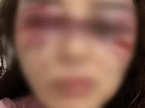 Xác minh cán bộ QLTT bị tố đánh đập dã man bạn gái khi hát karaoke