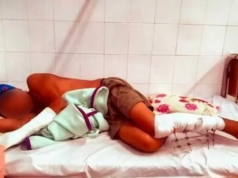 Xét xử 2 cha con đánh hàng xóm thương tật 46%