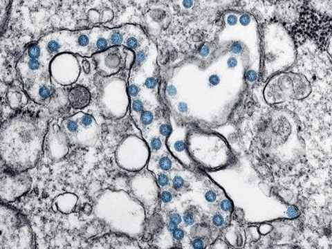 Một số ca Covid-19 mạn tính đã tạo nên biến chủng mới?