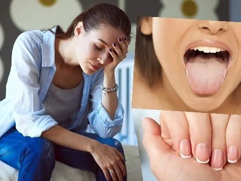 Dấu hiệu sức khoẻ cảnh báo bạn đang ăn uống quá mức nghèo nàn, cần bổ sung dinh dưỡng ngay