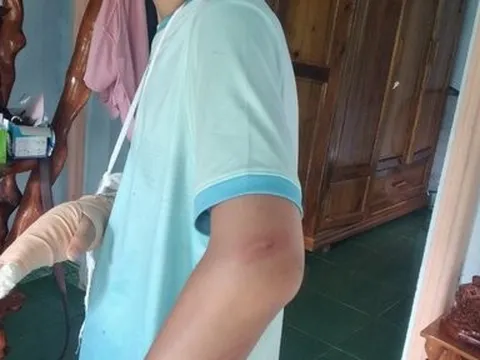 Bình Phước: Xác minh việc một học sinh lớp 9 vô cớ bị đánh gãy tay