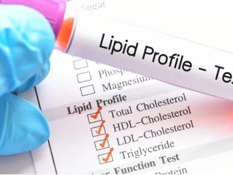 "Sát thủ thầm lặng" khiến 200.000 người Việt đột quỵ mỗi năm