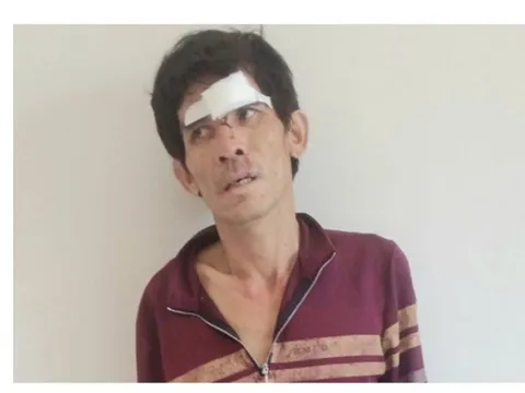 Quảng Nam: Bắt giữ đối tượng chuyên trộm cắp cây cảnh