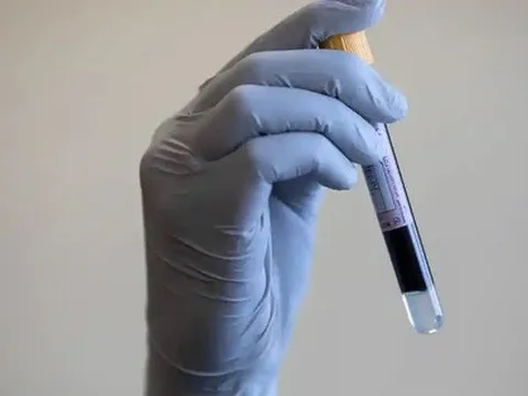 Xét nghiệm máu giúp phát hiện sớm nhiều loại ung thư