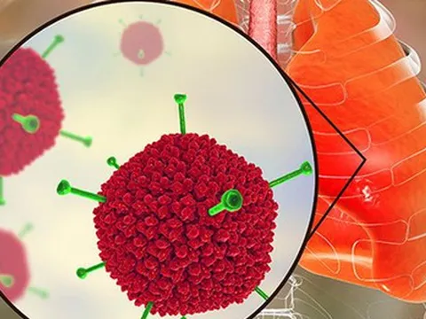 Virus Adeno mà nhiều trẻ đang nhiễm phải nguy hiểm ra sao?