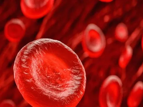 Nghiên cứu mới: Người có nhóm máu này có nguy cơ đột quỵ trước 60 tuổi cao hơn