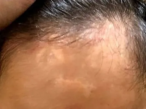 Vụ gửi con chữa bệnh, nhận về tro cốt: Thêm một nạn nhân lên tiếng