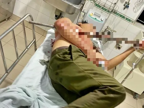 Ngăn chặn nhóm thanh niên hỗn chiến, tổ trưởng tổ dân phòng bị đâm