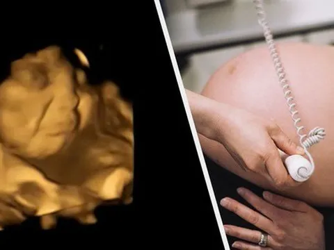 Thai nhi biết phản ứng khi ngửi thấy thức ăn trong bụng mẹ