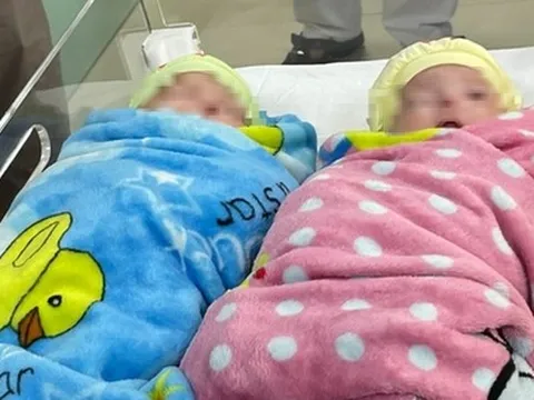 Cặp song sinh 25 tuần tuổi nặng 500 gram được nuôi dưỡng thành công