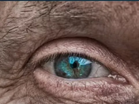 Đột phá: Dự đoán nguy cơ bệnh tim mạch bằng AI