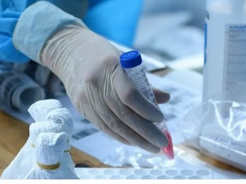 Làm sao để đấu thầu thuốc không còn tâm lý “sợ sai”?