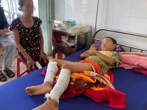 Nghi vấn cha dùng xăng và rơm đốt con trai ruột- Đề nghị công an điều tra