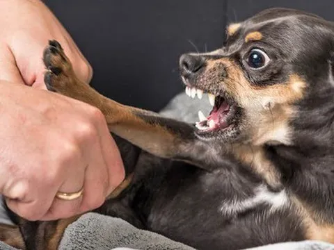 Nữ bác sĩ thú y tử vong do chủ quan với vết chó cắn nhỏ xíu trên ngón tay