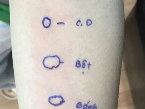 Cô gái trẻ ngất tại phòng tập do sốc phản vệ bột bánh mì