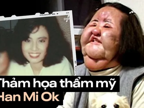 "Thảm họa thẩm mỹ" xứ Hàn: Nữ ca sĩ 17 lần phẫu thuật cứu vãn nhan sắc vì tự tiêm dầu ăn