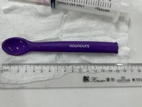 Hoảng hồn cô gái 20 tuổi nuốt luôn thìa nhựa 15cm vào bụng
