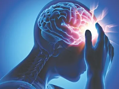 8 thay đổi lối sống giúp ngăn ngừa đột quỵ