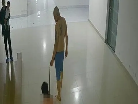 Khởi tố bị can vụ bạo hành con trai như thời trung cổ
