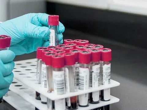 Lần đầu tiên truyền máu nuôi trong phòng thí nghiệm cho người