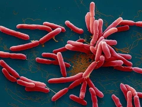 Bộ Y tế khuyến cáo người dân chủ động phòng bệnh Whitmore