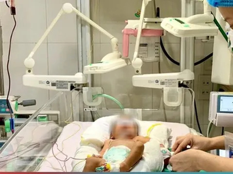 Bị vàng da bệnh lý, bé sơ sinh 6 ngày tuổi phải thay máu toàn phần