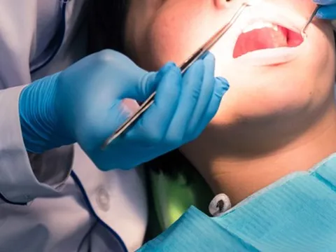 WHO: Gần một nửa dân số thế giới mắc bệnh răng miệng